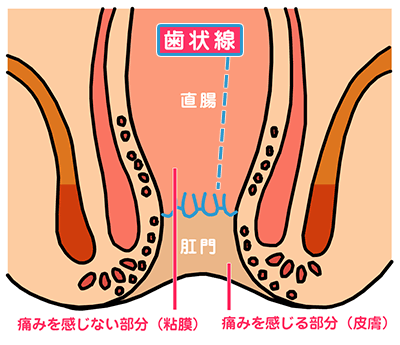 歯状線